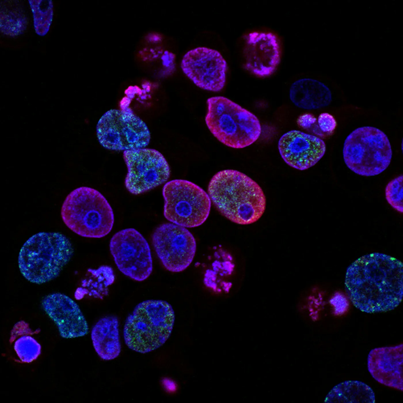 Fluorescence microscopy of stained cells